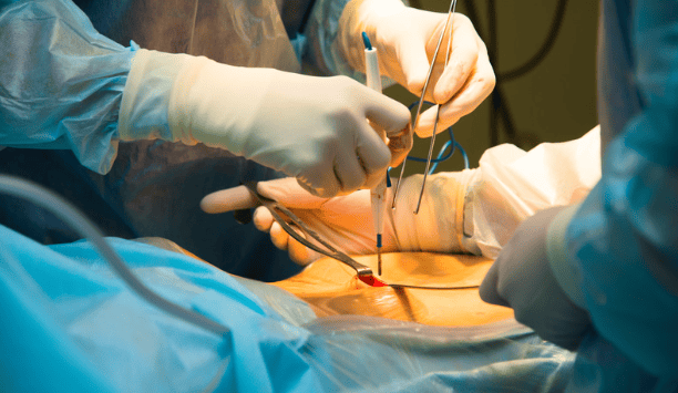 Fertility Surgery in Lucknow