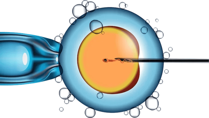 IVF Treatment in Lucknow